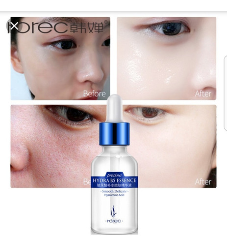 Imagen 3 de 7 de Hidra B5 Essence Con Ácido Hialurônico Suero Facial