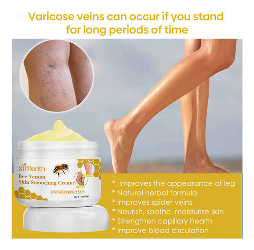 La Crema Reparadora De Venas De Abeja Alivia El Dolor E Hinc