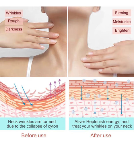 Lifting Regenerador Reafirmante Cuello Antiarrugas Retinol Mixta Día
