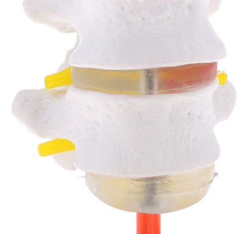Vértebra Lombar Da Coluna Vertebral Humana 1: 1 Com Modelo