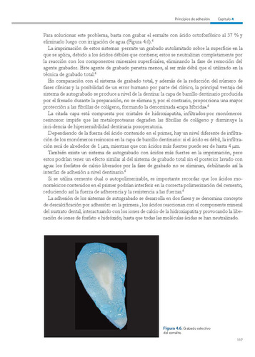 Cementación Adhesiva en Dientes Naturales Materiales y Técnicas de Giacomo Derchi Umberto Campaner Editorial Amolca Tapa Dura