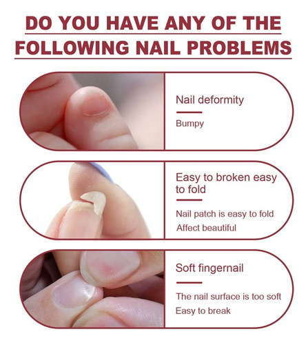 Fe Juego De Pegamento For Extensiones De Uñas Antigrietas