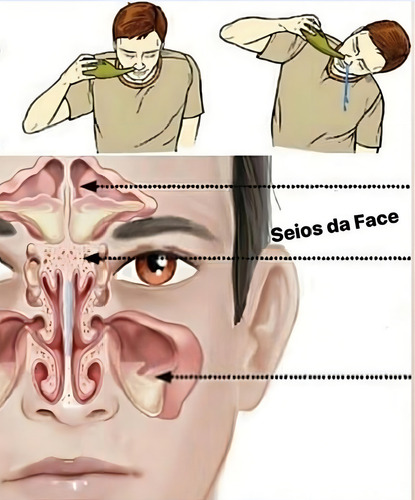 Jala Neti Lavador Nasal Limpador Neti Pot Indiano 150ml