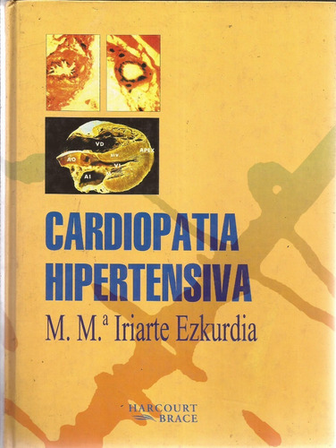 Cardiopatia Hipertensiva Mm Iriarte Ezkurdia  #30