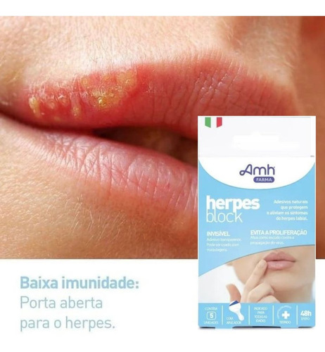 2 Herpes Block - Adesivos Naturais Para Herpes Labial - Amh