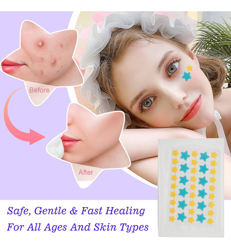 126 Almohadillas Hidrocoloides For Cubrir Pecas De Mujeres,