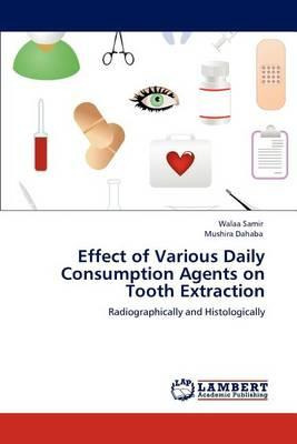 Libro Effect Of Various Daily Consumption Agents On Tooth...