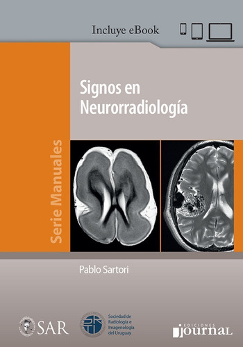 Sartori Signos En Neurorradiología 1ed/2020 Nuevo Env T/país