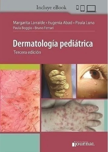 Dermatología Pediátrica, 3ed - Larralde 2021. Incluye E-book