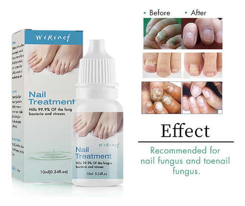 Esmalte Líquido Reparador De Uñas Y Líquido Para Uñas Y Uñas