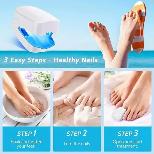 Lâmpada Led Para Fototerapia De Unhas