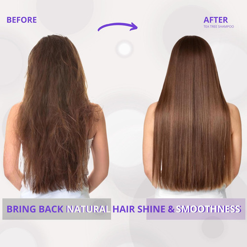 Shampoo Profissional Inova Tea Tree 11 Onças