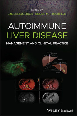 Libro Autoimmune Liver Disease - Neuberger, James