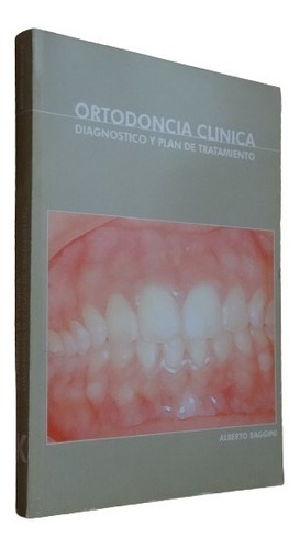 Ortodoncia Clínica Diagnóstico Y Plan De Tratamiento Baggini