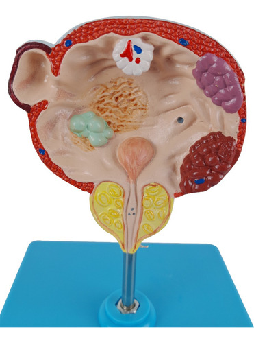 Anatomia Bexiga Urinária E Próstata Com Patologias Anatomia