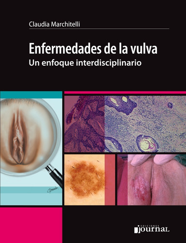 Marchitelli Enfermedades De La Vulva 1ed/2018 Nue Env T/país