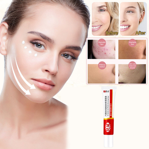 Pele Desidratada, Hidratante, Hidratante, Creme Facial 20g S