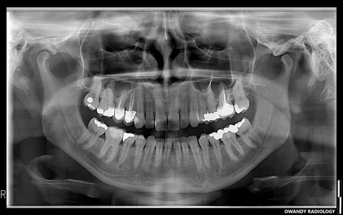 Imagen 2 de 2 de Panorámico Cefalométrico Dental Digital