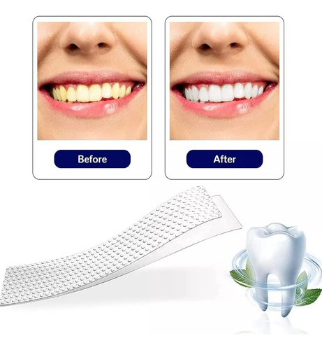14 Tiras Blanqueadoras Dentales 5d White Higiene Bucal