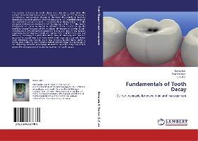 Libro Fundamentals Of Tooth Decay - Ravi Shankar