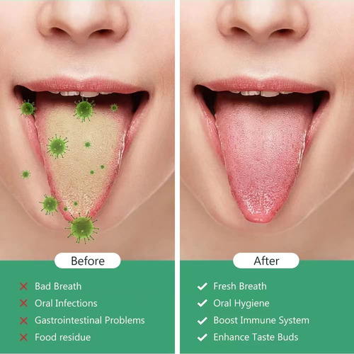 Limpiador Raspador De Lengua, Raspador De Lengua Con Caja