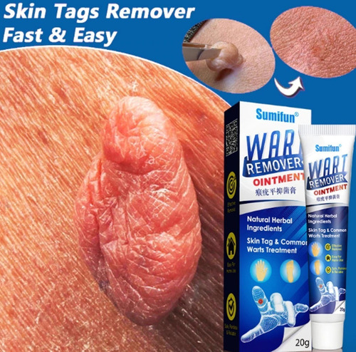 5 Peças De Creme De Remoção Instantânea De Manchas Removedor