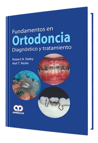 Fundamentos En Ortodoncia. Diagnóstico Y Tratamiento.