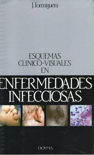 Enfermedades Infecciosas, Esquemas Clinico-visuales