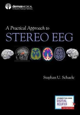 A Practical Approach To Stereo Eeg - Stephan U. Schuele