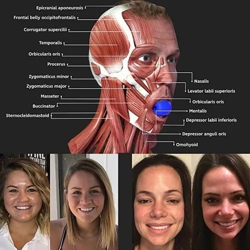Imagen 9 de 10 de 3 Piezas Ejercicios De Mandíbula De Fitness Facial