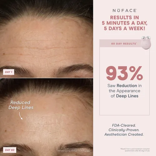 Dispositivo Facial Nuface Mini+ Microcurrent Con Gel Y Crema