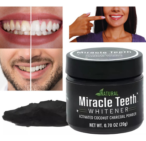 2 Pzas Blanqueador Dental Pasta Natural Carbon Miracleteeth 