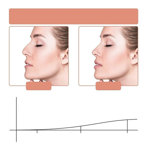 Nariz Perfecta Corrector Nasal Premium Bonita Respingada | Cuotas sin interés Nariz Perfecta Corrector Nasal Premium Bonita Respingada | Cuotas sin interés