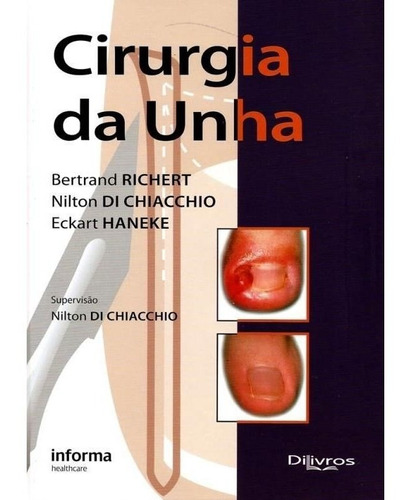 Livro - Cirurgia Da Unha - Richert