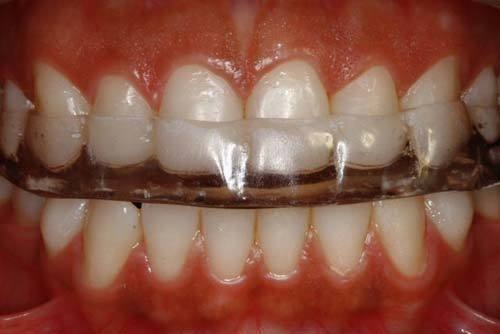 Dentista - Prótesis Dentales - Implantes - Extracciones
