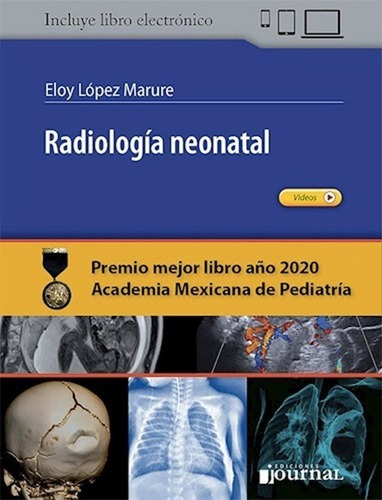 Radiología Neonatal - Eloy López Marure