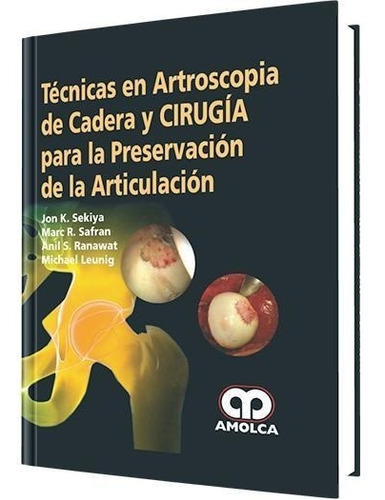 Técn. En Artroscopia De Cadera Y Cirugía Preservación Artic.
