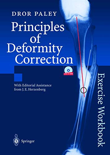 Principles Of Deformity Correction: Exercise Workbook