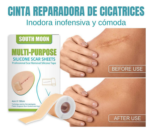 2 Rollos Cinta Silicona Reparación Cicatrices Marcas Pielab
