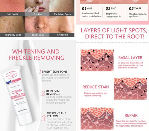 Crema Facial Blanqueadora Hidratante Elimina Manchas Pecas