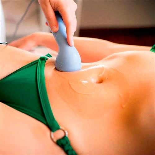 Imagem 4 de 5 de Sonopulse Compact Aparelho De Ultrassom 1mhz Fisioterapia