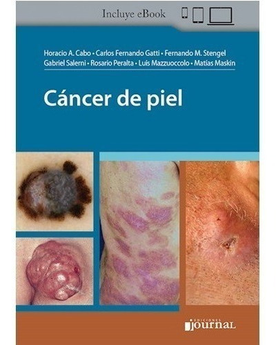 Cáncer De Piel Horacio Cabo Ediciones Journal