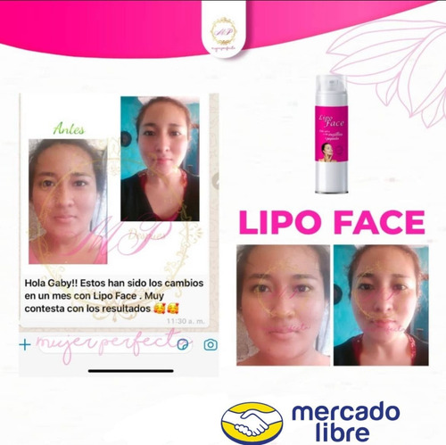 Gel Para Papada, Mejillas Natural Neutra