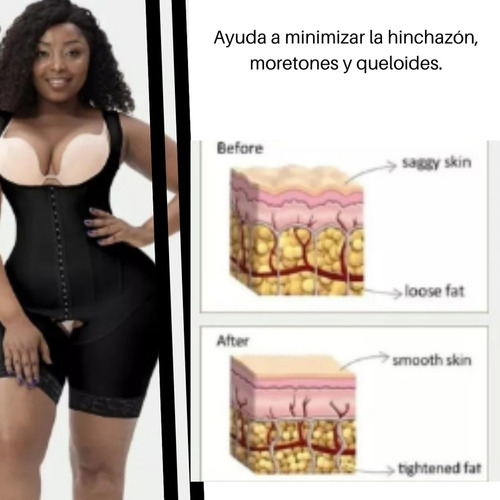 Faja Para Dama Moldeadora Reductora Liposuccion Postparto