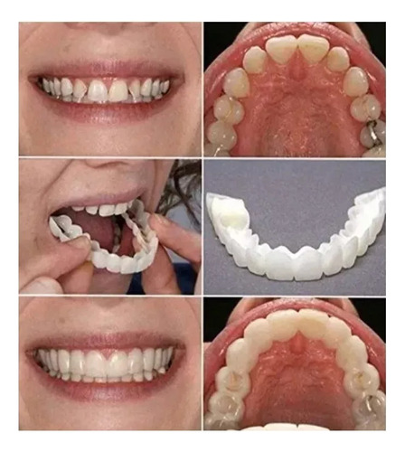 Prótesis Artificial Blanqueada De Segunda Mano