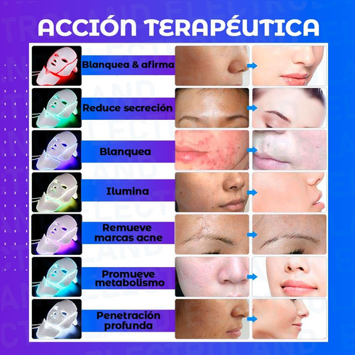 Imagen 8 de 10 de Mascara Fototerapia Facial Tratatamiento 7 Colores 192 Led