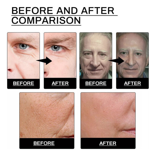 Creme Facial Com Bálsamo Sebáceo Redutor De Rugas*1