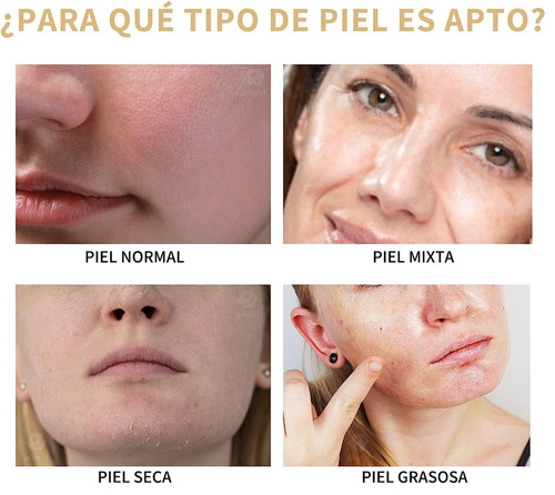 Solución Tonificante De Ácido Glicólico Al 7% The Ordinary 2 Todo Tipo De Piel