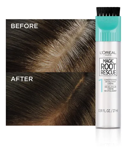 Kit Para Teñir El Cabello L'oreal Paris Magic Root Rescue Da