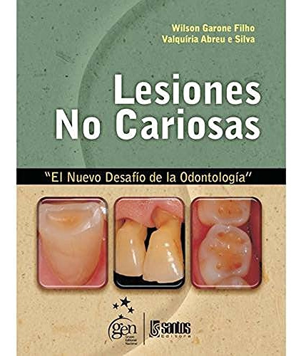 Libro Lesiones No Cariosas De Wilson Garone Filho Ed: 1